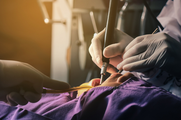 Recovering From Bone Grafting