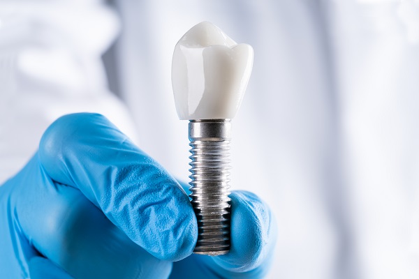 Step By Step Guide To Dental Implant Placement From An Oral Surgeon